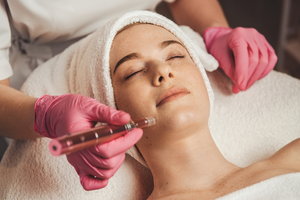 Woman rests with eyes closed during PRF microneedling